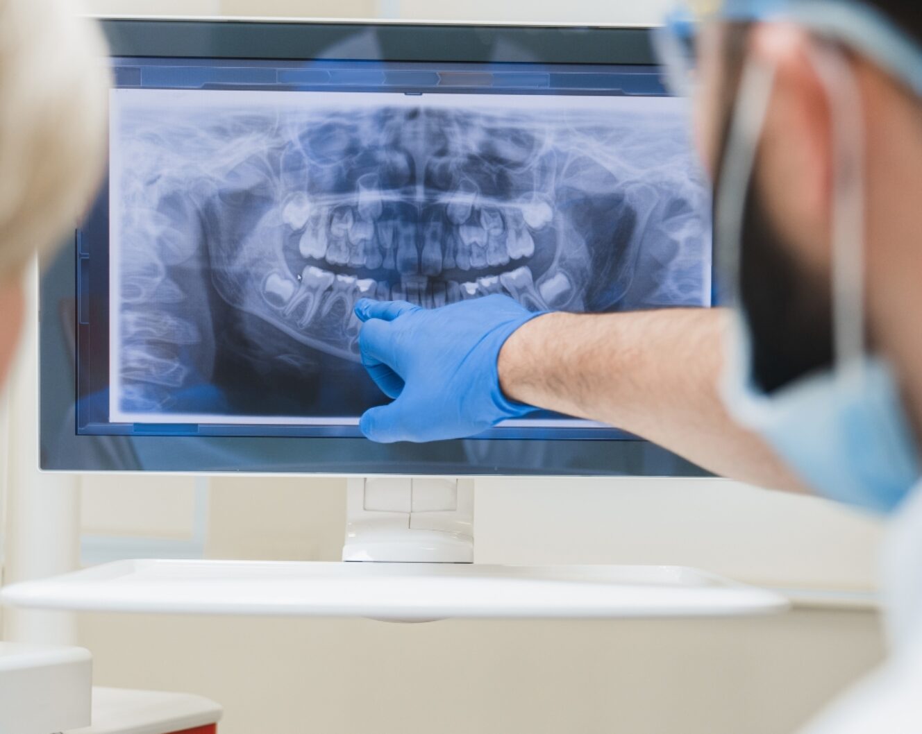 Root canal treatment